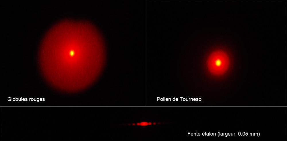Image de granulom�trie sur globule rouge �Rob in Space